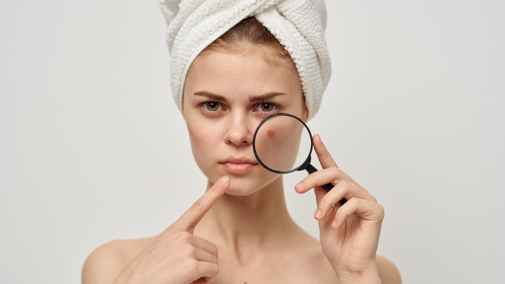 Can Skincare Products Cause Acne?